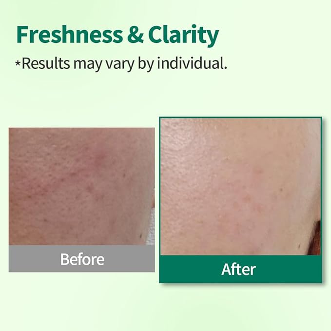 1.618 Korean Foam Face Wash - pH 6.5 Balanced Tea Tree Cleanser – Salicylic Acid & Plant-Based Formula for Blemish-Prone, Oily Skin | 5.07 oz