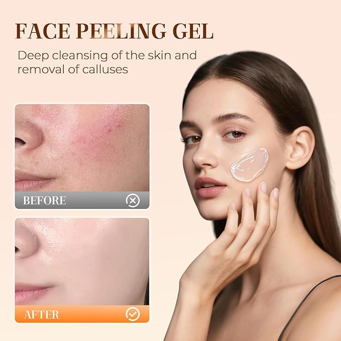 Facial Exfoliating Gel, Orange Exfoliating Gel Scrub for Face and Body, Orange Peeling Glue Remove Blackheads & Moisturize Skin for All Types Skin (A-2Pcs, One Size)