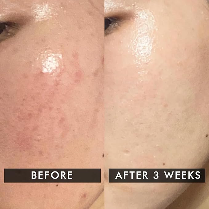 Conscious Chemist® Snail Magic Skin Barrier Repair All In One Cream | Daily Repair Gel Cream with Korean Snail Mucin Extract | 50g / 1.7fl.oz