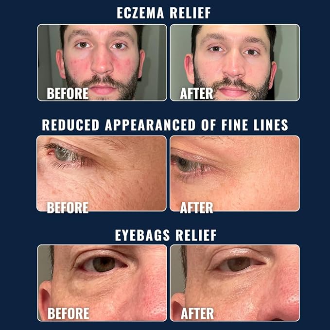 Prettyboy Face Revival Gel Moisturizer For Men - Hydrating Cream That Refreshes Dry Skin, Irritation, & Redness - Supports Anti Aging & Anti Wrinkle - Fragrance Free - 2 Count