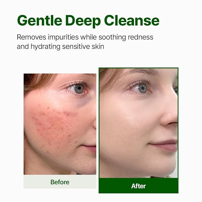 NACIFIC Cica PDRN Gel Cleanser 6.76 fl oz 200ml – Centella Asiatica, Low pH Deep Pore Cleanser for Sensitive Skin, Soothing & Purifying Korean Face Wash