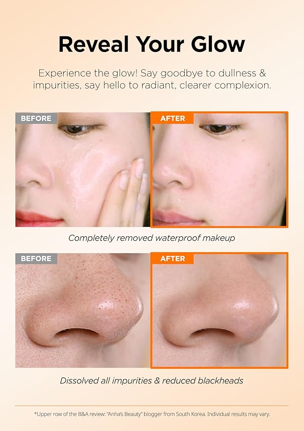 Hanskin AHA Pore Cleansing Balm – Korean Melting Balm Cleanser, Gentle Makeup Remover for Dry, Dull Skin | Solid-to-Oil Cleanser with AHA & Nourishing Oils | K-Beauty | 2.82 oz