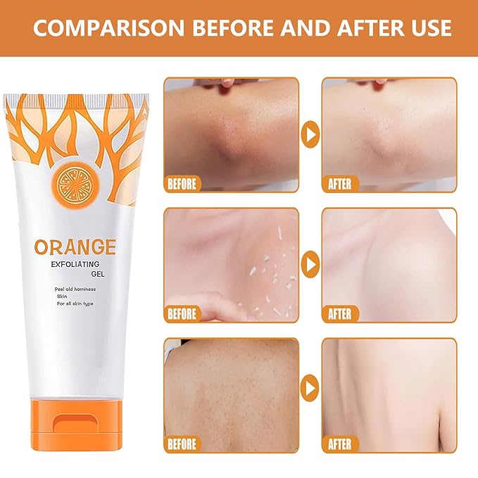 Orange Exfoliating Gel Scrub Face Body Skin Peeling Gel Face Scrub Deep Cleansing Moisturizing Facial Exfoliator Natural Orange Peeling Facial Cream for Women Skin Care (2PCS)