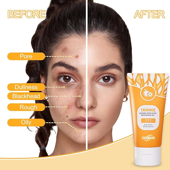 Orange Exfoliating Gel Scrub for Face and Body, Orange Peeling Gel, Deep Clean Pores, Remove Blackheads & Moisturize Skin, Orange Exfoliating Gel for All Types Skin (1PC)