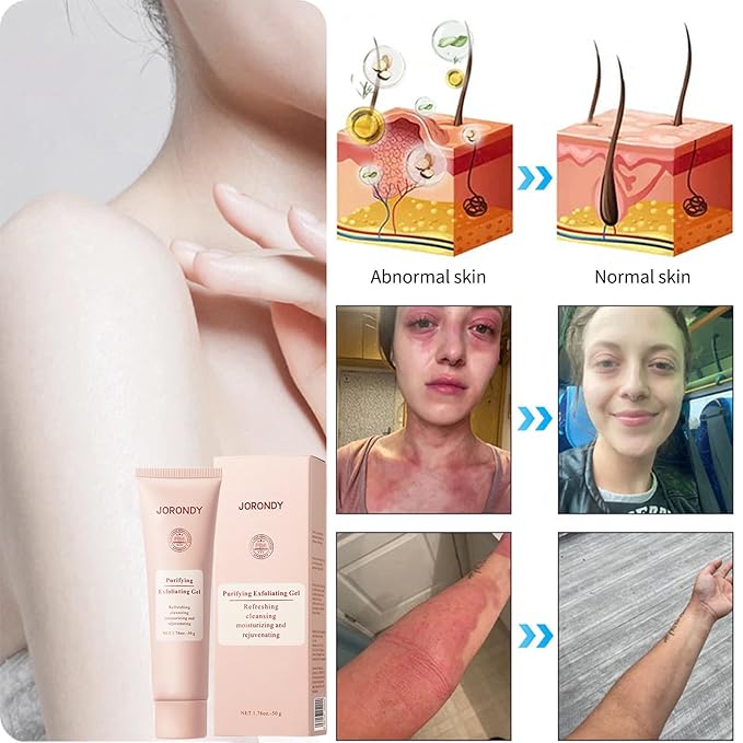 JORONDY Purifying Exfoliating Gel, JORONDY Purifying Enzymes Exfoliating Gel, Deep Cleansing and Moisturizing Formula for All Skin Types (2 Pack)