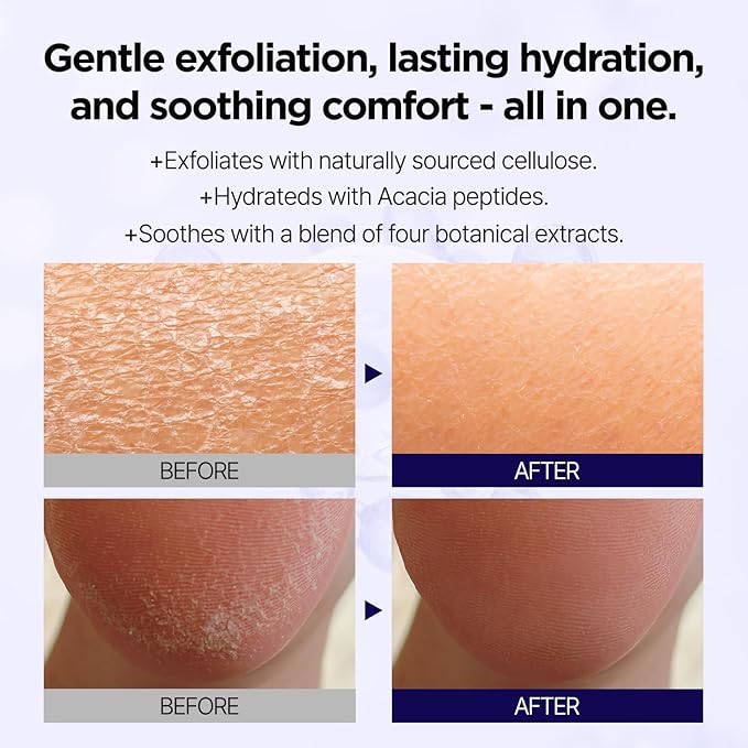 PONGDANG Deep Clean Soft Peeling Gel 4.23oz | Daily Exfoliator for Dead Skin & Blackhead Care | Pore-Minimizing & Safe for Sensitive Skin | Cruelty-Free | Korean Skin Care