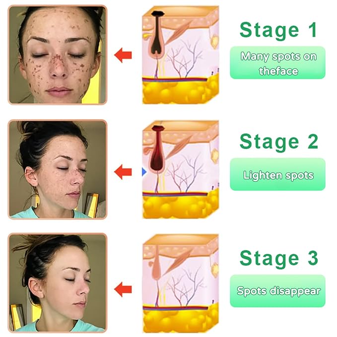 JORONDY Purifying Exfoliating Gel, JORONDY Purifying Enzymes Exfoliating Gel, Deep Cleansing and Moisturizing Formula for All Skin Types (2 Pack)