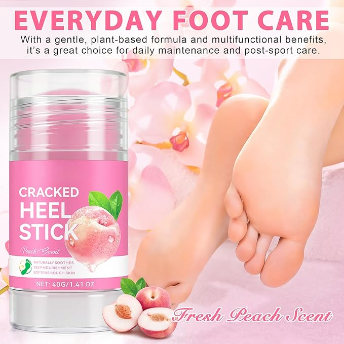 Urea Cream Foot Callus Remover Stick - 60% Urea with 2% Salicylic Acid, Professional Strength Moisturizer for Dry Cracked Feet, Heels, Knees, Elbows & Hands, Callus Removal & Skin Softening Treatment