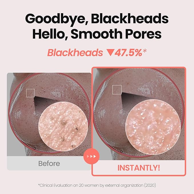 [K-Beauty] Rose Vitamin Oil to Foam - All-in-One Korean Face Wash OilBased Foaming Facial Cleanser - Pore Minimizing & Blackhead Remover - Makeup Deep Cleansing Oil for All Skin Types (3.88 fl oz)