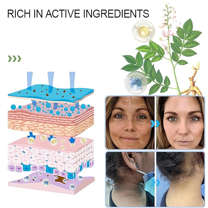 JORONDY Purifying Exfoliating Gel, JORONDY Purifying Enzymes Exfoliating Gel, Deep Cleansing and Moisturizing Formula for All Skin Types (2 Pack)