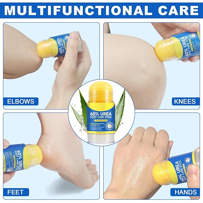 60% Urea with 2% Salicylic Acid Foot Care Stick, Hydrating Repairs Feet Cream, Foot Lotion Moisturizer for Dry Cracked Feet, Elbows, Hands (1.41 Ounce (Pack of 1))