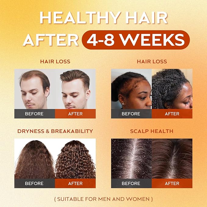 Batana Oil for Hair Growth Dr Sebi, 100% Raw Organic Batana Hair Mask from Honduras, Wild Growth Hair Oil, Scalp Oil Promotes Hair Thickness, Prevents Loss for Men & Women, 2 fl oz