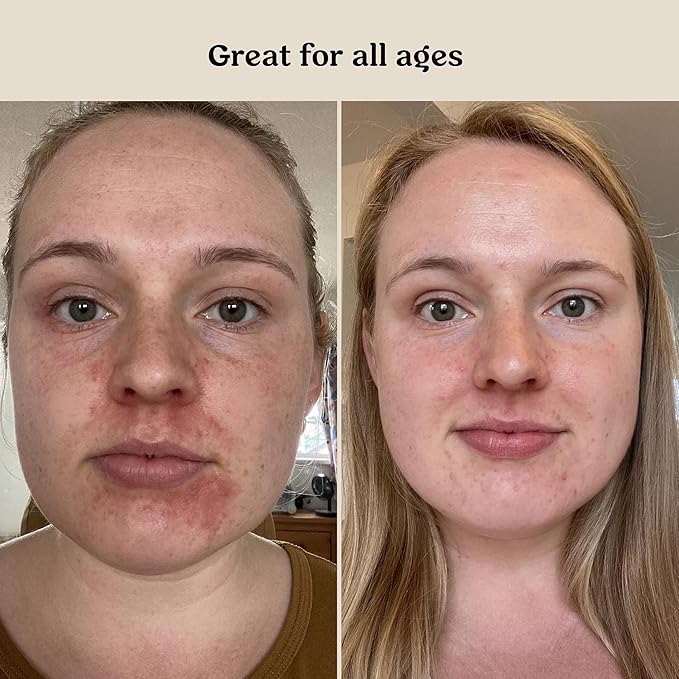 Roe Wellness- Baby Serum Hydrating Skincare EWG Verified Non-Toxic Ingredients Probiotic Protection | Hydrate, Soothe, Safe For All Skin Babies, Infants, Toddlers & Kids (Power Serum)