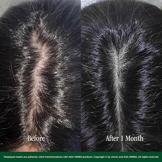 | 100% Natural Pre-Shower/Overnight Hair Oil Mask, Hair Treatment - Cold Pressed Oils, Vit. E, Squalane from Olive, (8.45 Fl. Oz.)