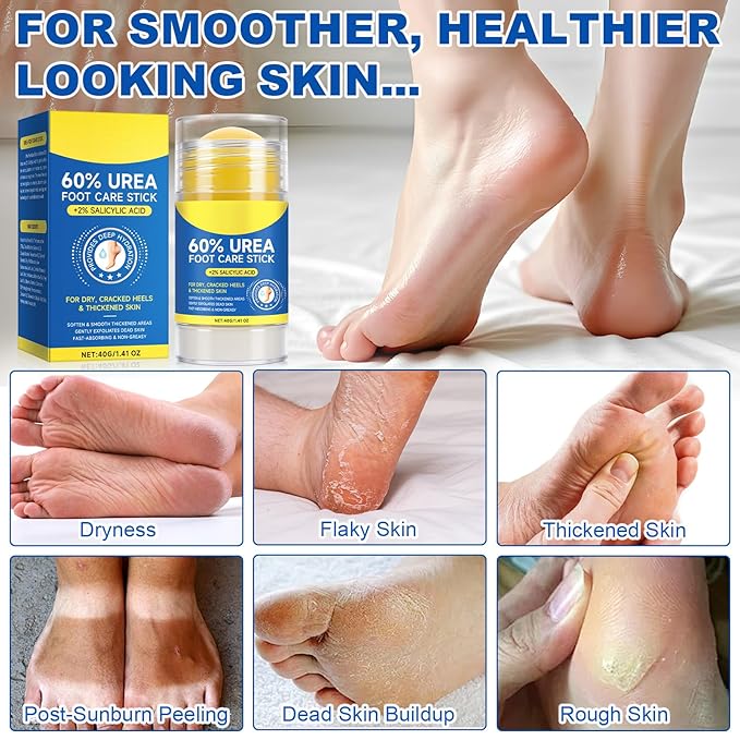 60% Urea with 2% Salicylic Acid Foot Care Stick, Hydrating Repairs Feet Cream, Foot Lotion Moisturizer for Dry Cracked Feet, Elbows, Hands (1.41 Ounce (Pack of 1))